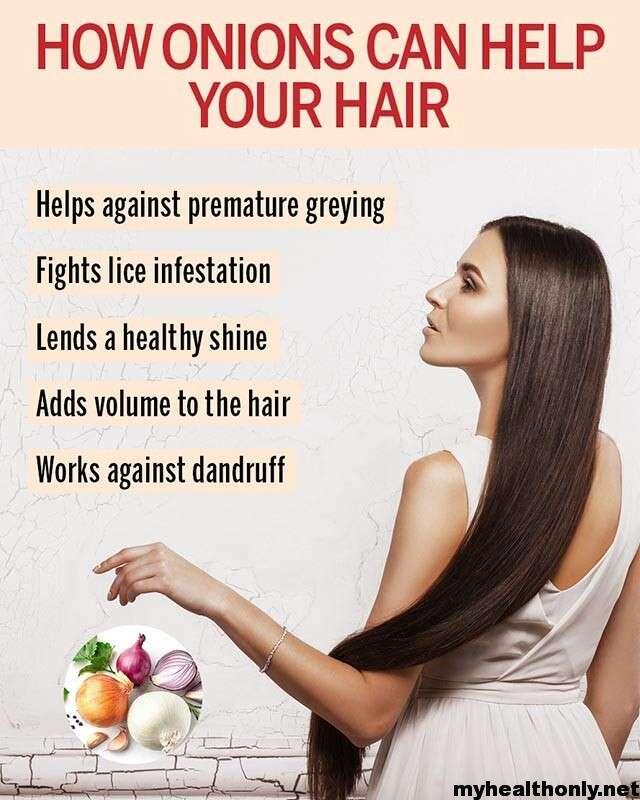 Health Benefits of Onion for Hair 