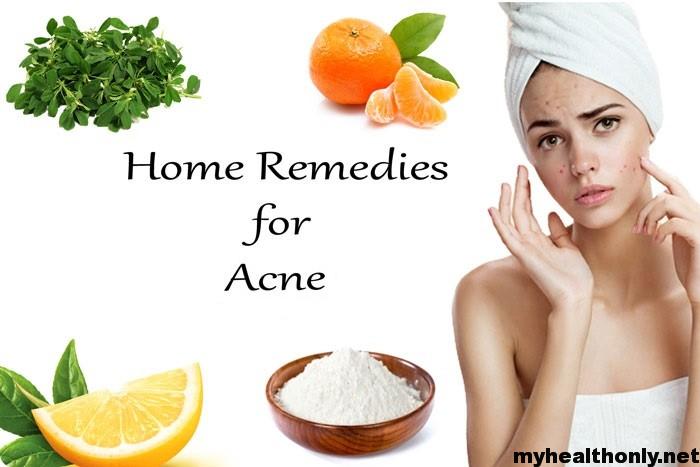 Home Remedy for Acne