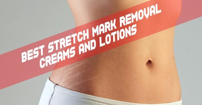 Best Removal Cream for Stretch Marks..
