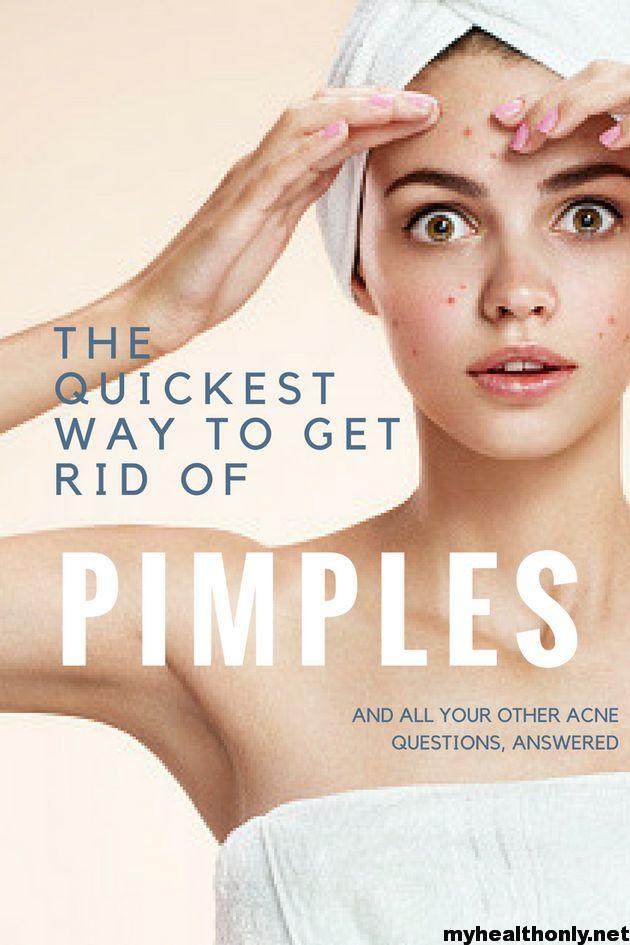 To Know How to Remove Pimples