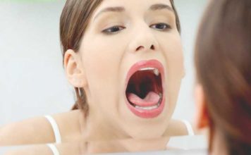 White Tongue Prevention