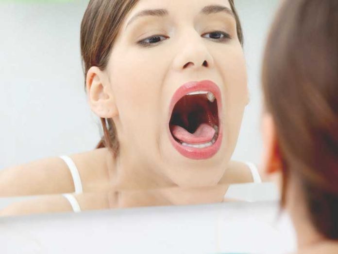 White Tongue Prevention