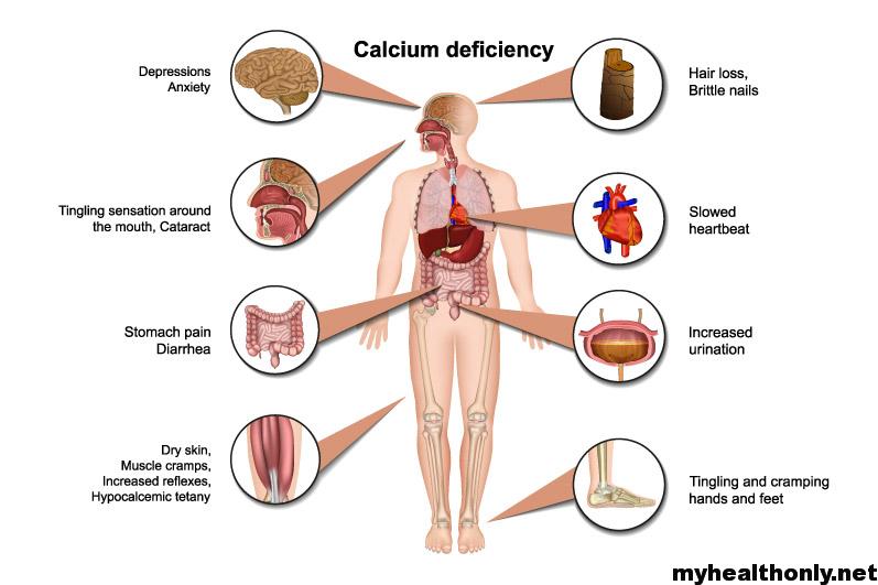 Treatment, Causes and Symptoms of Calcium Deficiency

