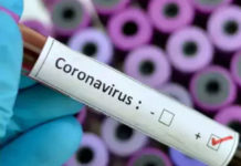 Died Due to Coronavirus