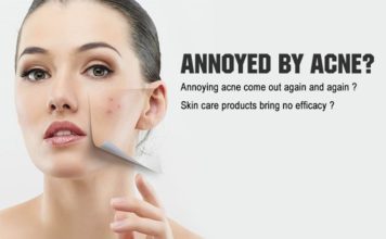 To Know How to Remove Pimples