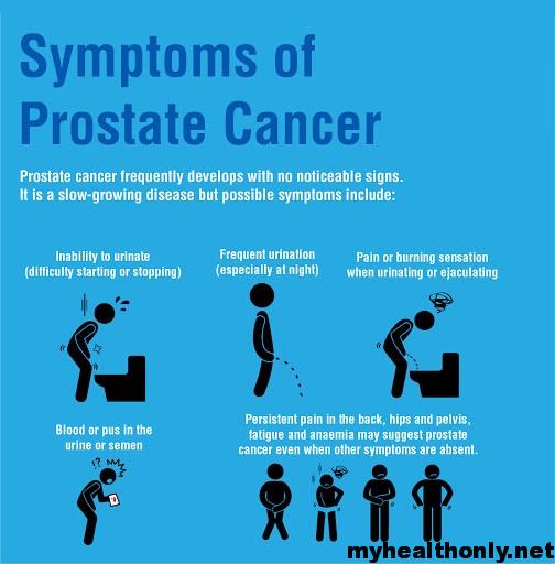 prostate cancer symptoms early égő szúró érzés vizeléskor