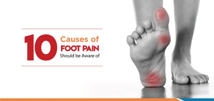 Do not ignore these causes of foot pain, You should know - My Health Only