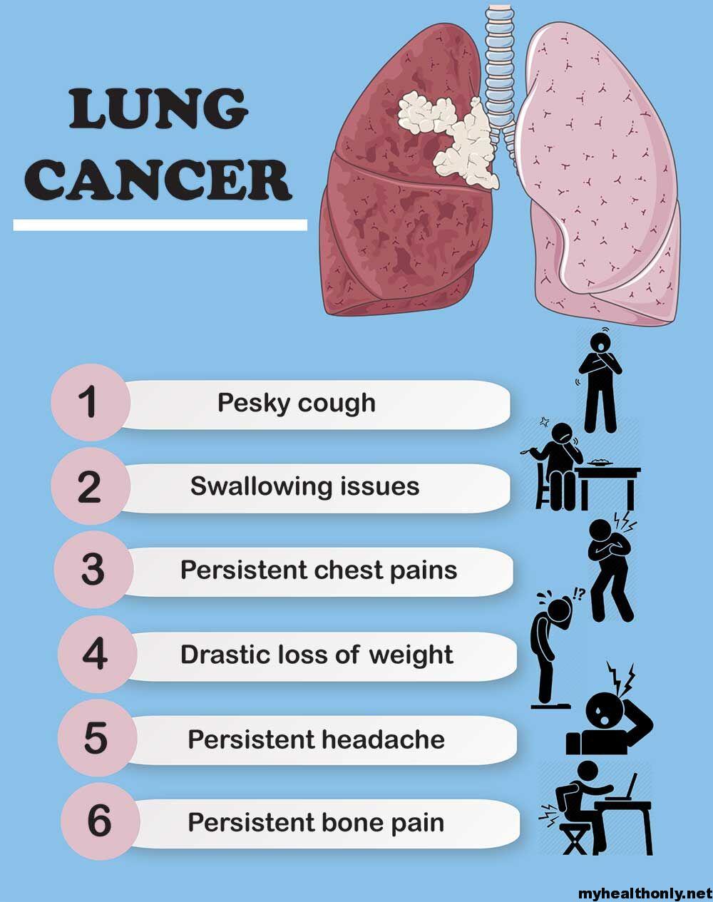 Symptoms of Lung Cancer, Causes, Signs & Risk Factors - My Health Only