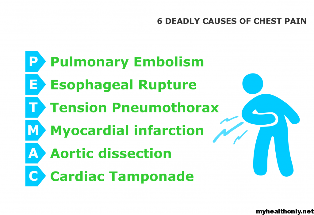 Do not ignore these causes of chest pain, You must know