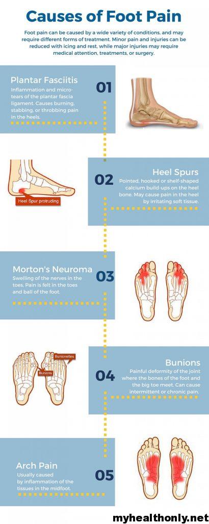 Do not ignore these causes of foot pain