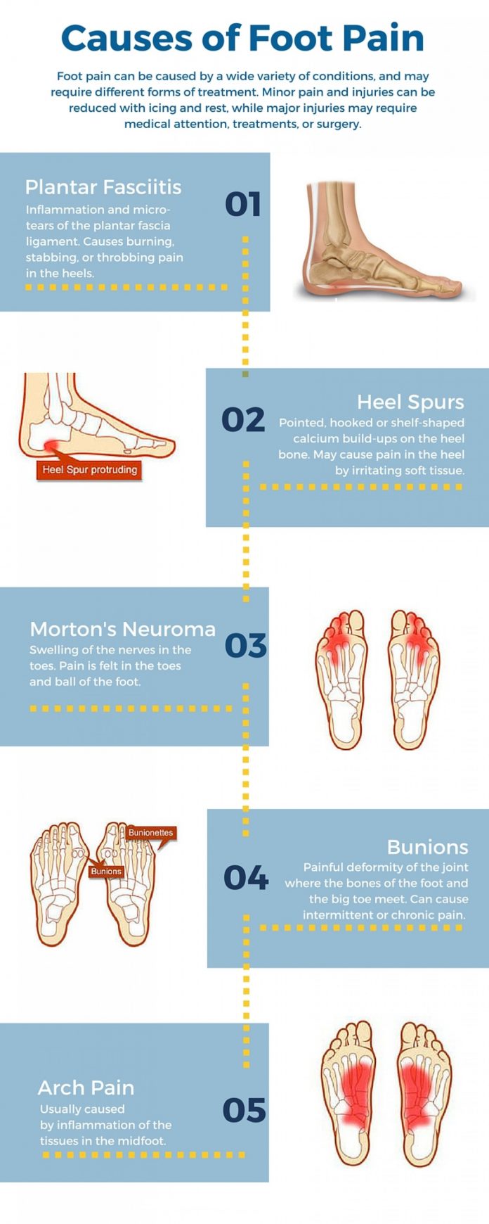 Do not ignore these causes of foot pain, You should know My Health Only