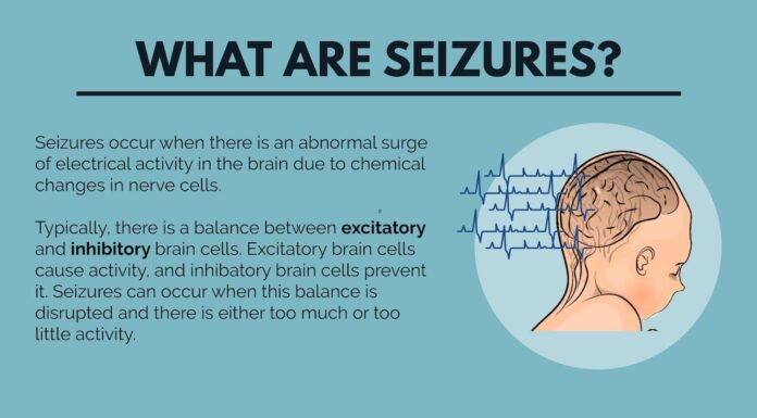 what can cause a seizure