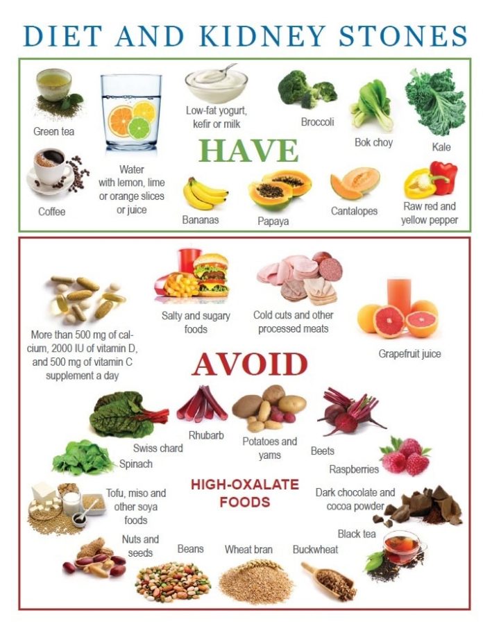 Diet for Kidney Stones What not to eat in kidney stones My Health Only