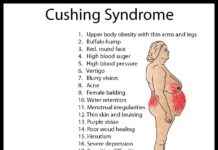 Cushing syndrome - Types, Symptoms, Causes & Treatment