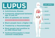 Lupus Symptoms, Causes, Diagnosis, Treatment & Complications
