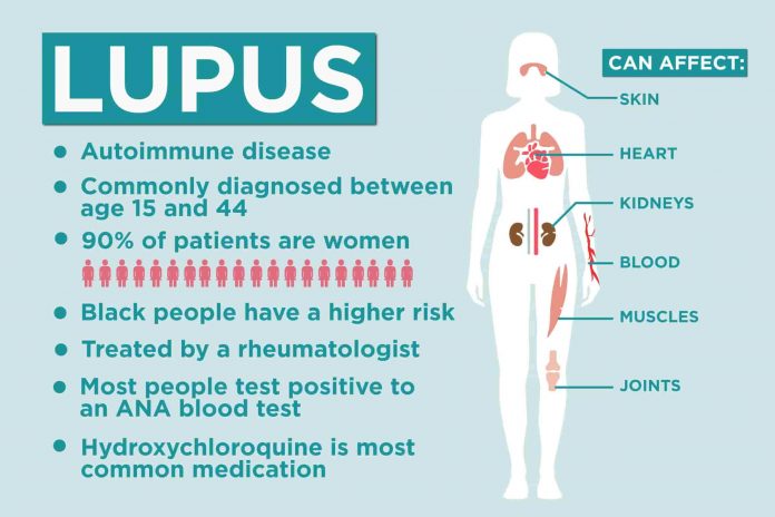 Lupus Symptoms, Causes, Diagnosis, Treatment & Complications