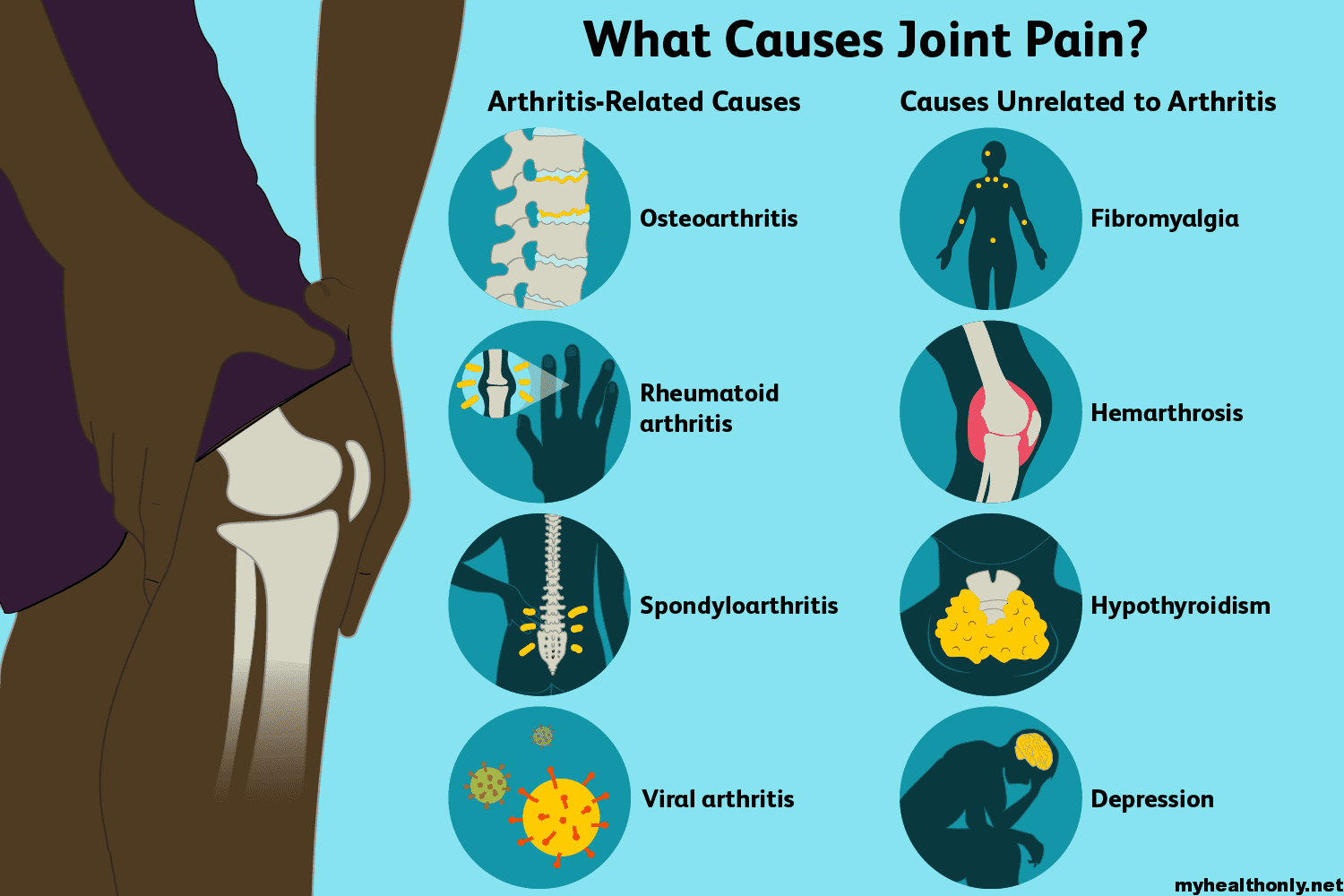 Causes of Joint Pain: Symptoms, Signs, Causes & Treatment