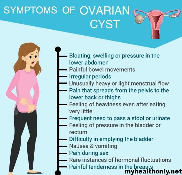 Ovarian Cyst Symptoms