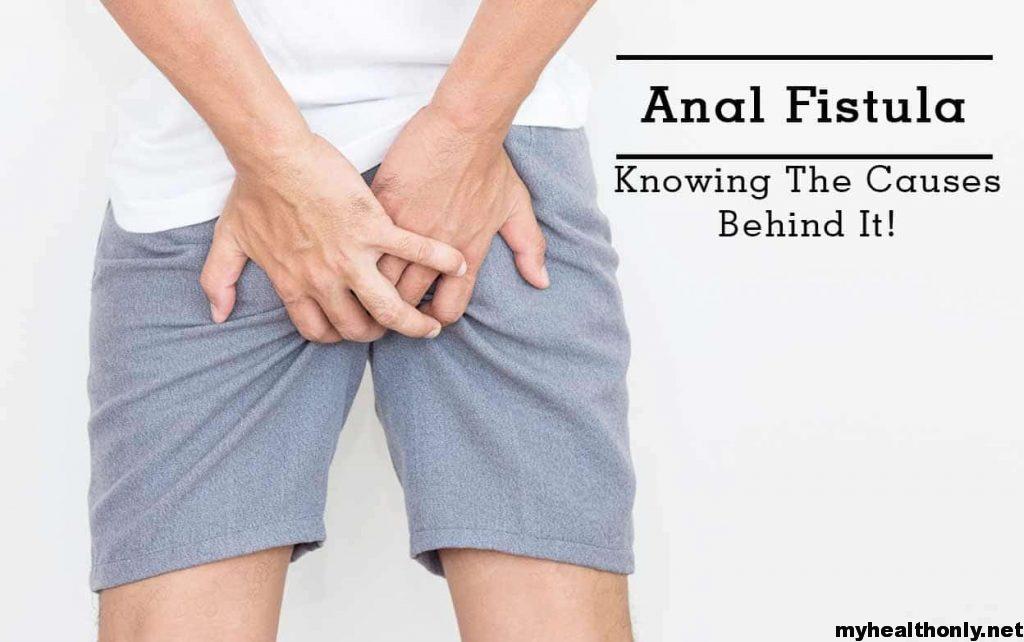 Anal Fissure: Types, Symptoms, Causes, Risk Prevention & Treatment