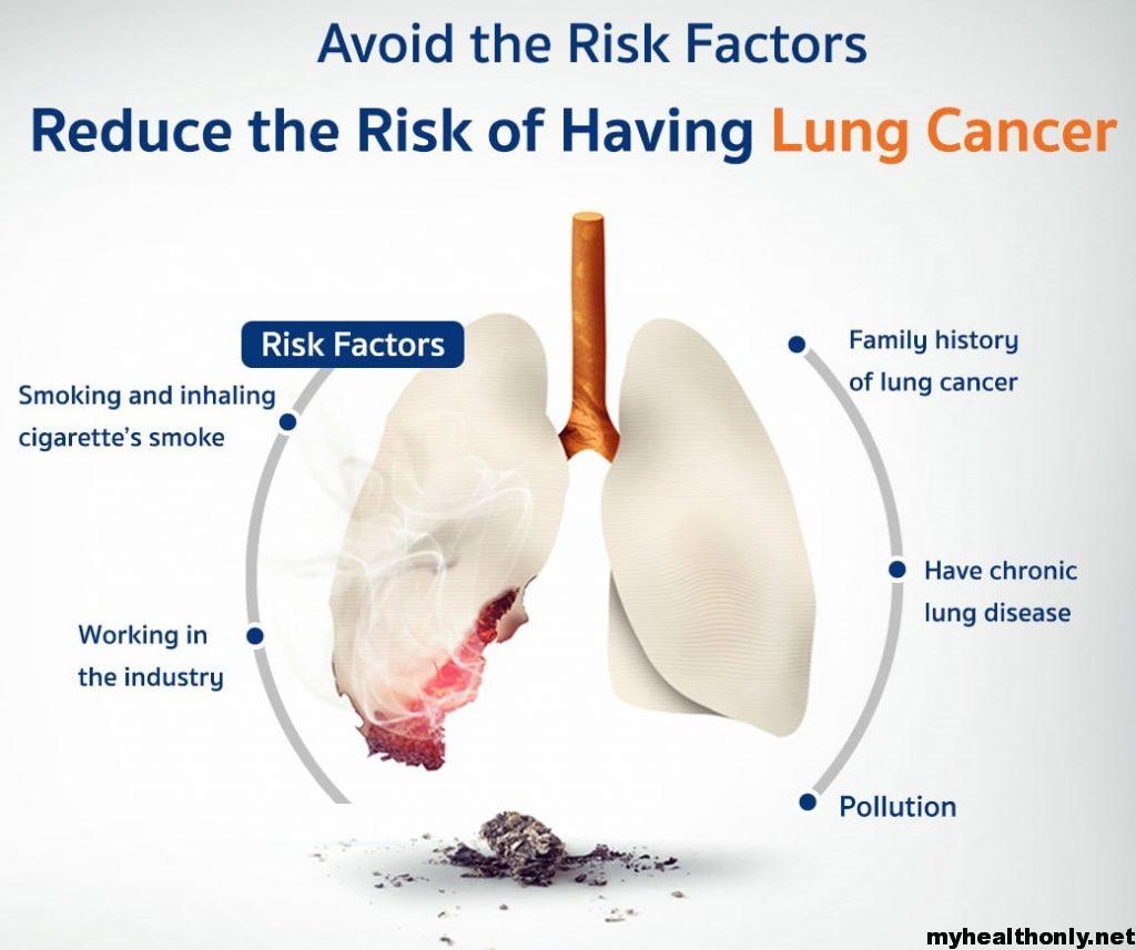 Lung Disease Risk Factors