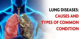Lung Disease Causes