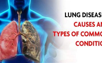 Lung Disease Causes