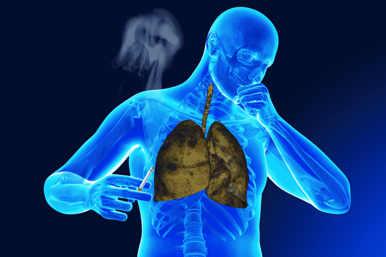 chronic-lung-diseases-prevention-diagnosis-treatment-complications