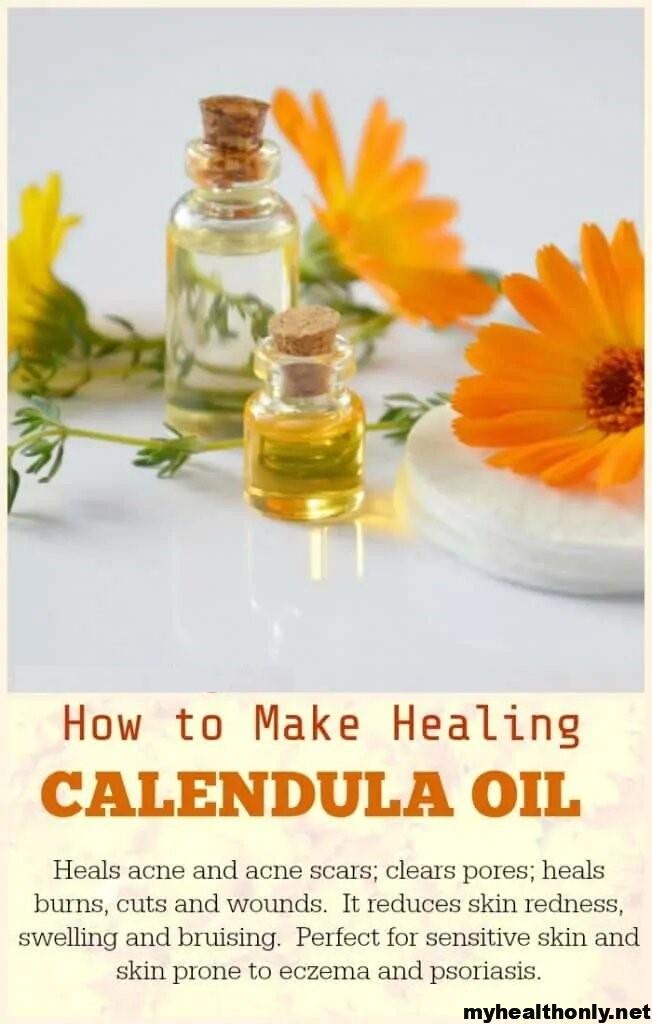 A number of benefits are associated with calendula flowers