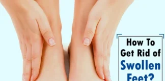 How To Get Rid Of Swollen Feet Fast?