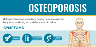 Osteoporosis: Symptoms, Causes, Tests & Treatment