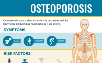 Osteoporosis: Symptoms, Causes, Tests & Treatment