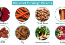 Vitiligo Diet
