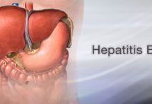 A life lived with Hepatitis B.