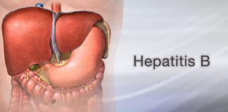 A life lived with Hepatitis B.