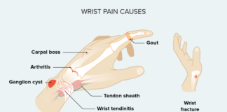 Hand Pain Causes, Symptoms & Home Remedies