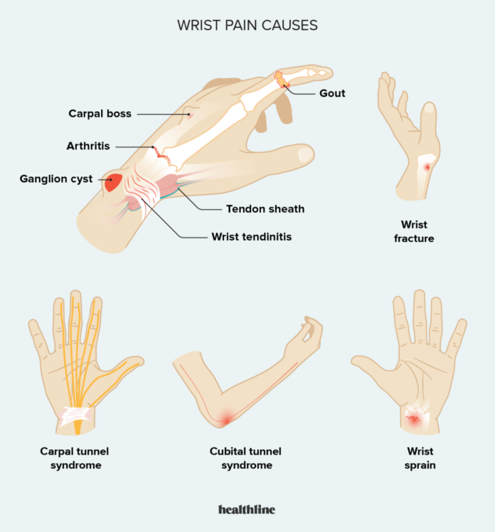 Hand Pain Causes, Symptoms & Home Remedies