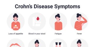 An overview of Crohn's disease's causes, symptoms, and treatments