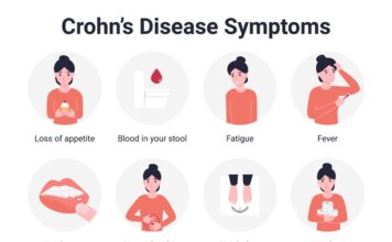 An overview of Crohn's disease's causes, symptoms, and treatments