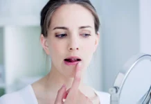 Keep the area clean: Wash your face and lips gently with a mild cleanser twice a day. Avoid scrubbing the affected area harshly, as it can further irritate the skin.
