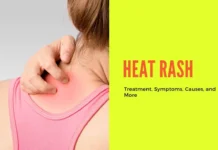 Heat rash, also known as prickly heat or miliaria, can occur in adults when sweat ducts become blocked, trapping sweat beneath the skin's surface. This blockage is often caused by a combination of factors.