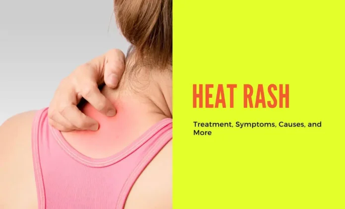 Heat rash, also known as prickly heat or miliaria, can occur in adults when sweat ducts become blocked, trapping sweat beneath the skin's surface. This blockage is often caused by a combination of factors.