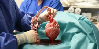 Man's hope for advancing medicine through pig-to-human heart transplant ends in tragedy as he dies weeks after the procedure.