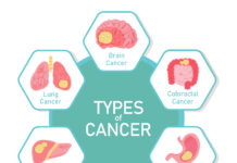 Illustration showing various types of cancer, including breast, lung, prostate, skin, colon, leukemia, lymphoma, and brain cancer, highlighting affected areas of the human body.